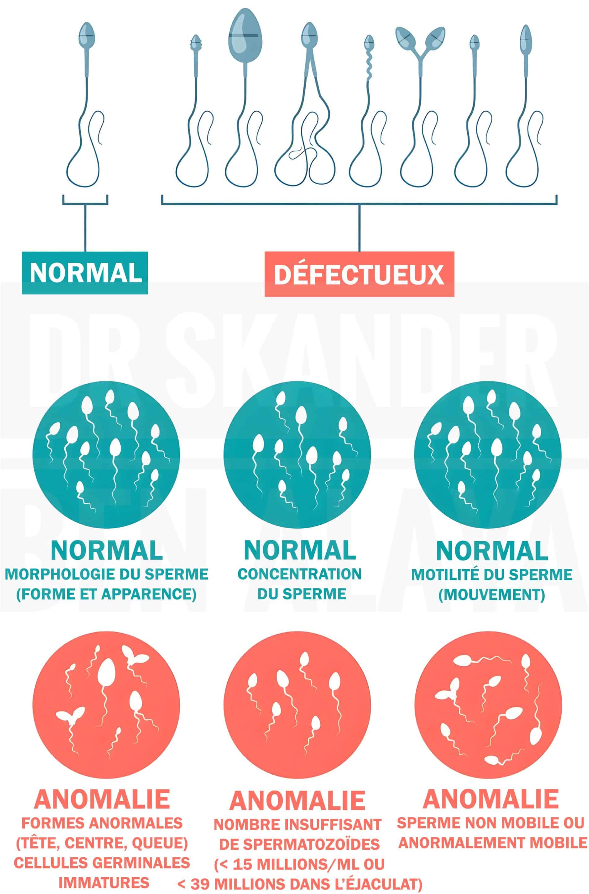 Le spermogramme est un examen clé pour la fertilité masculine.