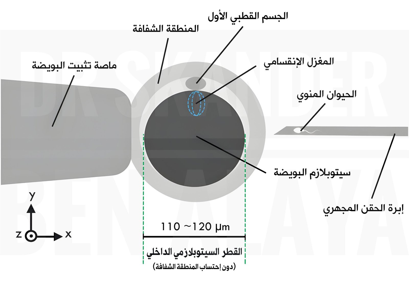 الحقن المجهري التلقيح المجهري - الحقن المجهري: حقن الحيوان المنوي داخل البويضة تحت المجهر لتلقيحها.